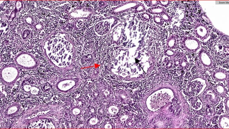 La nefrocalcinosis es muy común en pisciculturas noruegas