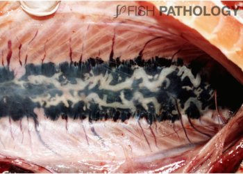 Nefrocalcinosis: Factores predisponentes y efectos