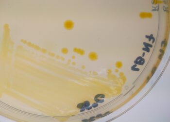 Chilenos identifican nueva bacteria del género Flavobacterium