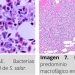 Ficha Técnica: Descubre los hallazgos de Piscirickettsiosis en salmónidos (SRS)