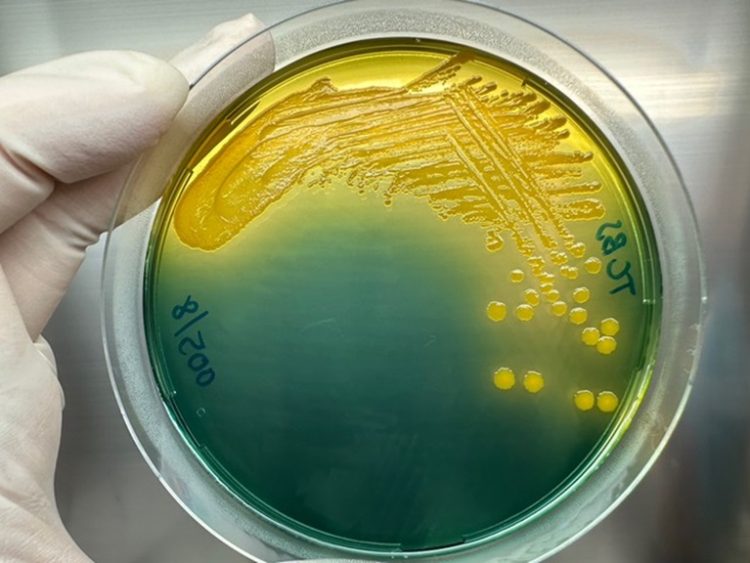 Panorama global de regulaciones para el uso de antibióticos en la acuicultura