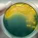 Panorama global de regulaciones para el uso de antibióticos en la acuicultura
