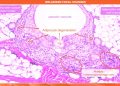 Degeneración y necrosis de adipocitos sería clave en melanosis muscular en salmón