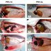 Principales hallazgos de patología macroscópica en salmones coho infectados por PRV1b y PRV3a asociados a enfermedad clínica
caracterizada por anemia e ictericia. Créditos Pathovet.