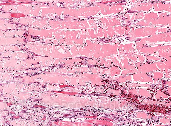 La necrosis muscular aguda en peces: Un desafío para la acuicultura