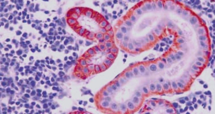 HQ Hipoxia (Riñón). Pez sometido con expresión de marcador a nivel epitelio tubular renal. Marcador fisiológico desarrollado por VeHiCe. Créditos VeHiCe.