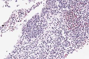 PHARMAQ Analytiq analiza desafíos bacterianos del salmón en el primer trimestre 2025 en Noruega