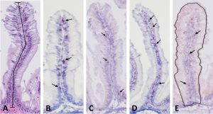 Fucoidan del kelp potencia inmunidad, microbiota y salud intestinal del salmón del Atlántico