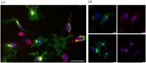 Los secretos de la proteína p33: un hallazgo clave en el virus de la miocarditis en peces