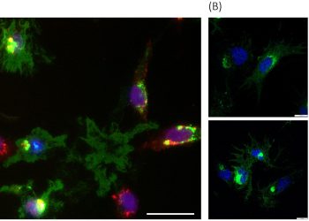 Los secretos de la proteína p33: un hallazgo clave en el virus de la miocarditis en peces