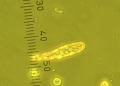 Microfotografía de Pseudochattonella, la especie de microalga potencialmente letal que mantiene en alerta máxima a las áreas productivas PO1 y PO2 en la costa sur de Noruega, obligando a la industria a desplegar modelos predictivos. Foto: Havforskningsinstituttet