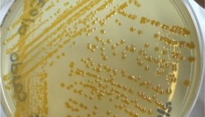 Nueva bacteria descubierta en piscicultura chilena abre interrogantes sanitarias y ecológicas