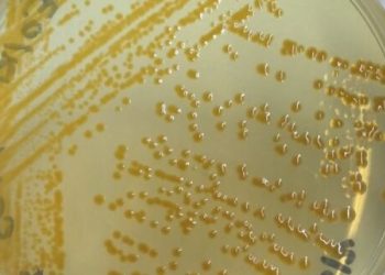 Nueva bacteria descubierta en piscicultura chilena abre interrogantes sanitarias y ecológicas