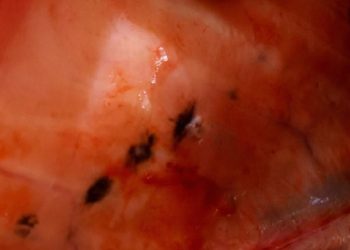 Ciencia chilena destapa el origen de las manchas en el salmón y abre camino a su prevención