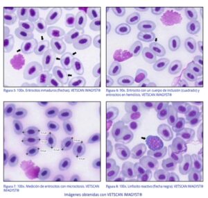 La importancia del estudio de la sangre en las infecciones por Piscine orthoreovirus