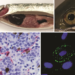 Imágenes de referencia sobre anemia infecciosa del salmón (ISA)