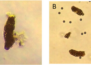 Fig. 2. Imágenes de pellets fecales de A. tonsa que contienen microesferas de poliestireno después de 24 h. A) Microesferas de 10 µm a una concentración de 1.000 microesferas mL⁻¹; B) microesferas de 10 µm a una concentración de 10.000 microesferas mL⁻¹. Las imágenes fueron tomadas con un aumento de 10× y posteriormente recortadas y ampliadas para facilitar su visualización. Créditos: Estudio.