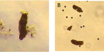 Fig. 2. Imágenes de pellets fecales de A. tonsa que contienen microesferas de poliestireno después de 24 h. A) Microesferas de 10 µm a una concentración de 1.000 microesferas mL⁻¹; B) microesferas de 10 µm a una concentración de 10.000 microesferas mL⁻¹. Las imágenes fueron tomadas con un aumento de 10× y posteriormente recortadas y ampliadas para facilitar su visualización. Créditos: Estudio.