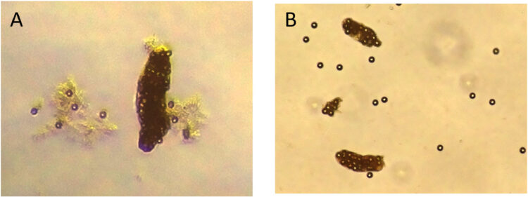 Fig. 2. Imágenes de pellets fecales de A. tonsa que contienen microesferas de poliestireno después de 24 h. A) Microesferas de 10 µm a una concentración de 1.000 microesferas mL⁻¹; B) microesferas de 10 µm a una concentración de 10.000 microesferas mL⁻¹. Las imágenes fueron tomadas con un aumento de 10× y posteriormente recortadas y ampliadas para facilitar su visualización. Créditos: Estudio.