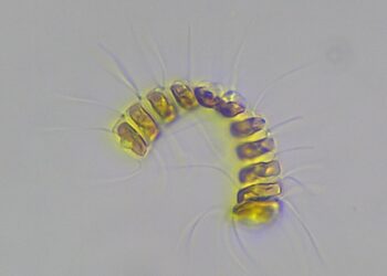 Imagen microscópica de fitoplancton usada en ADICFito, la plataforma de Plancton Andino