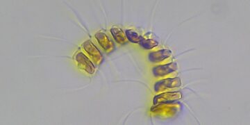 Imagen microscópica de fitoplancton usada en ADICFito, la plataforma de Plancton Andino