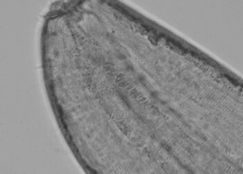Nematodos marinos descubiertos por el Dr. Matthew Lee, del Centro i~mar