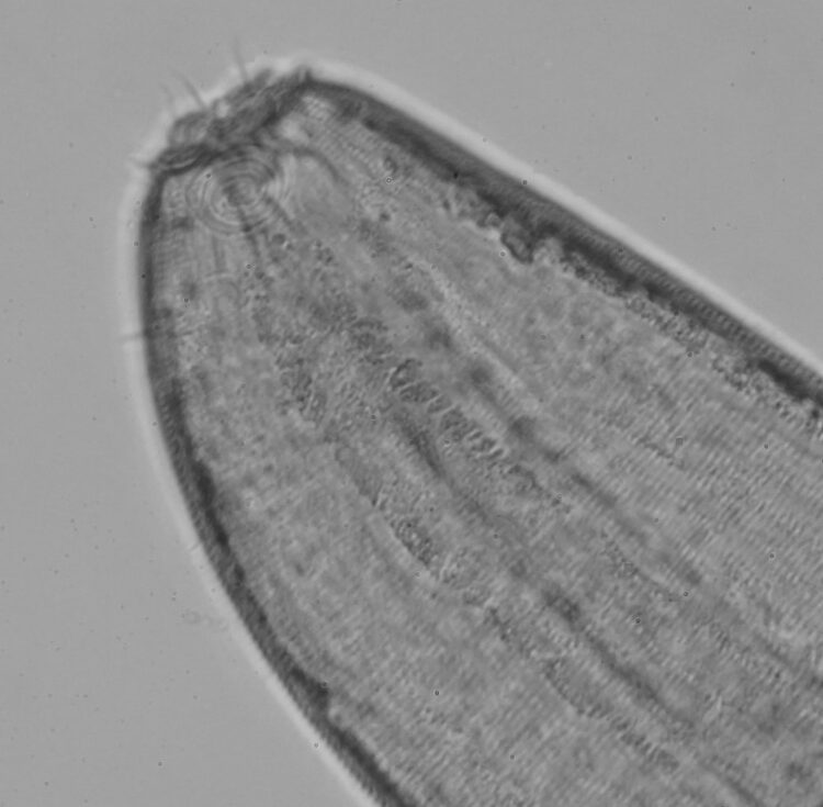 Nematodos marinos descubiertos por el Dr. Matthew Lee, del Centro i~mar