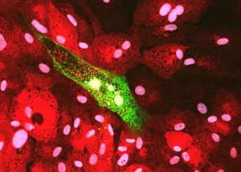 Microfotografía de células de piel de salmón Atlántico con señal fluorescente verde asociada a IPNV.