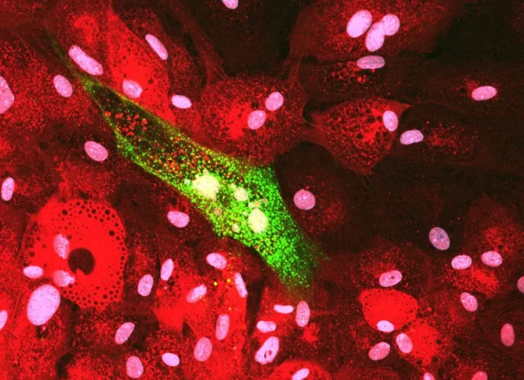 Microfotografía de células de piel de salmón Atlántico con señal fluorescente verde asociada a IPNV.